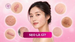 sẹo là gì