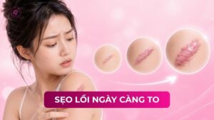 sẹo lồi ngày càng to sẹo lồi ngày càng to