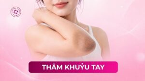 thâm khuỷu tay
