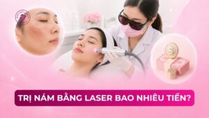trị nám bằng laser bao nhiêu tiền
