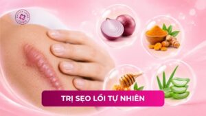 trị sẹo lồi tự nhiên trị sẹo lồi tự nhiên