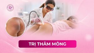 trị thâm mông
