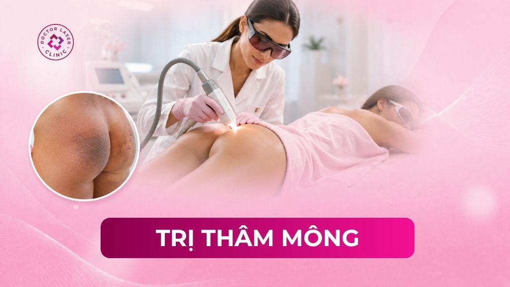 Cách trị thâm mông hiệu quả chuẩn y khoa theo bác sĩ da liễu