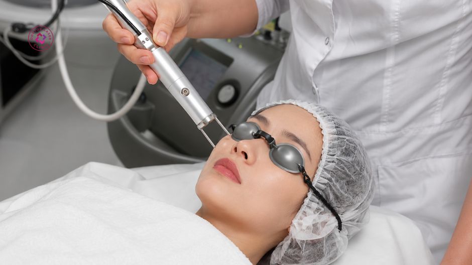 trị thâm mụn bằng laser có hiệu quả không