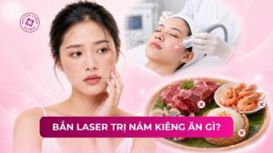 bắn laser trị nám kiêng ăn gì