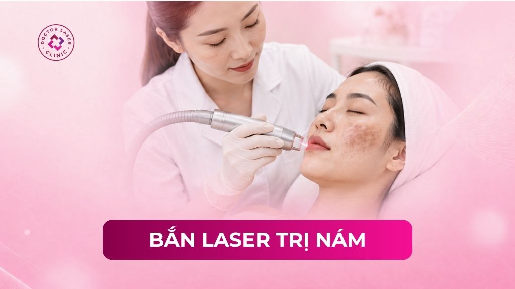 Bắn laser trị nám có hiệu quả không? Phân tích rõ ưu nhược điểm