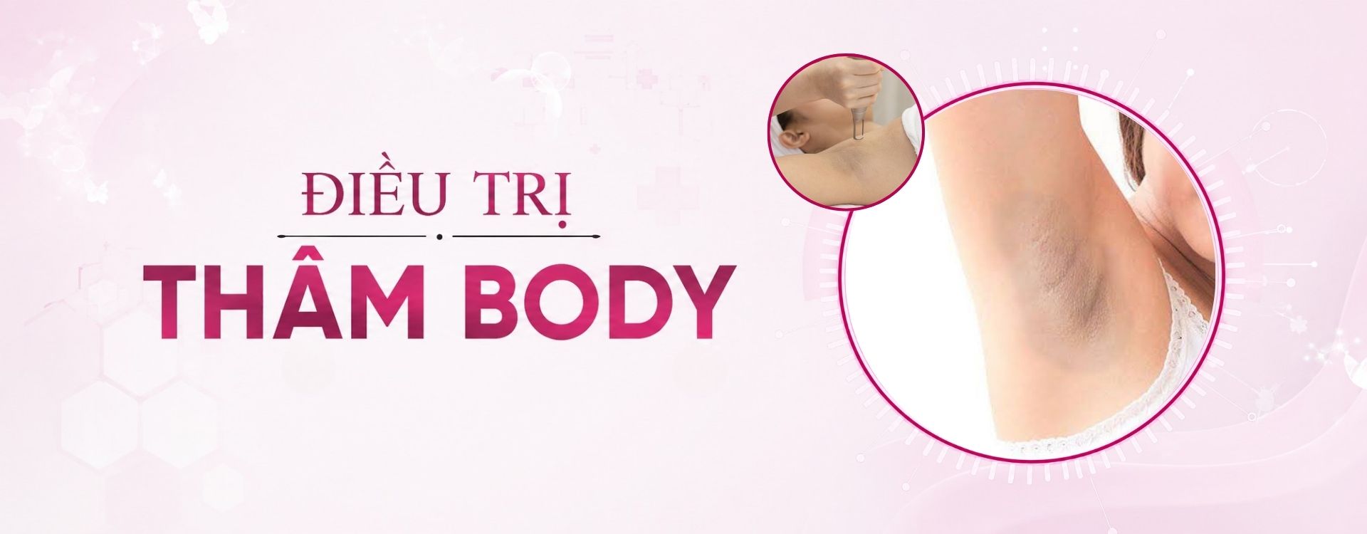 banner dịch vụ điều trị thâm body desktop