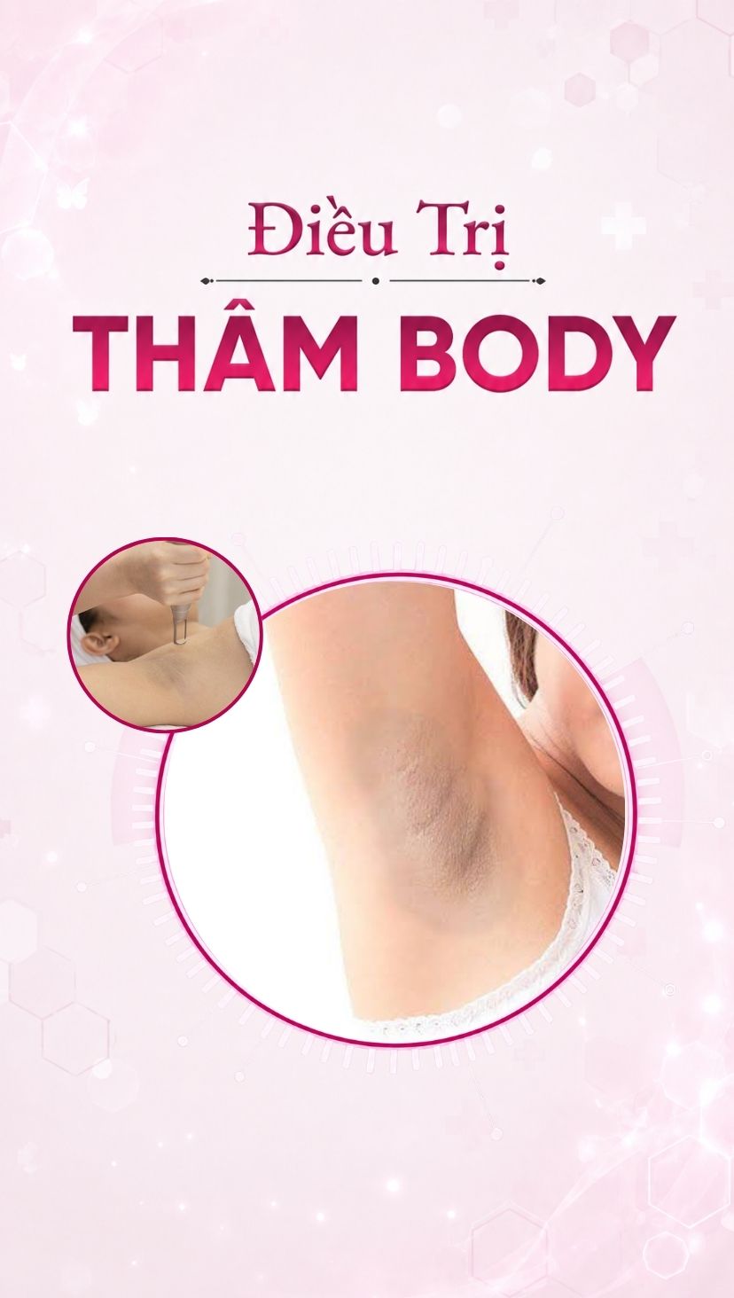banner dịch vụ điều trị thâm body mobile