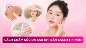 cách chăm sóc da sau khi bắn laser trị nám