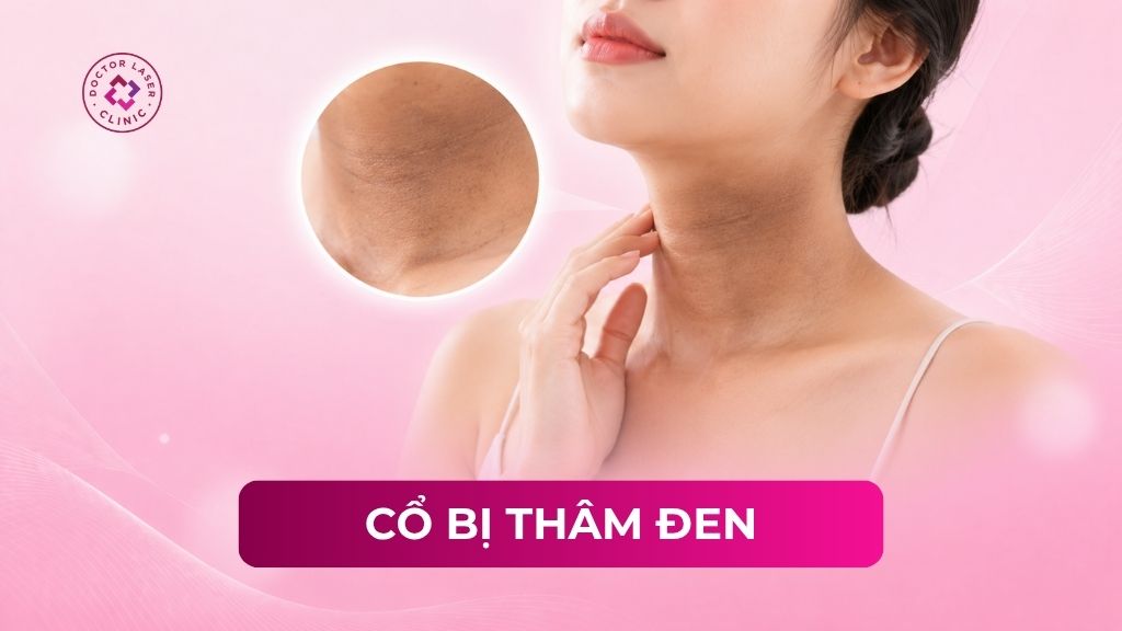 Cổ bị thâm đen là do đâu? Các phương pháp điều trị hiệu quả