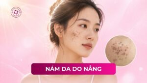 nám da do nắng