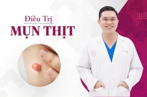 dịch vụ điều trị mụn thịt