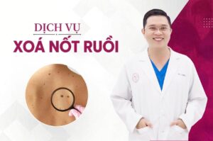 dịch vụ xóa nốt ruồi