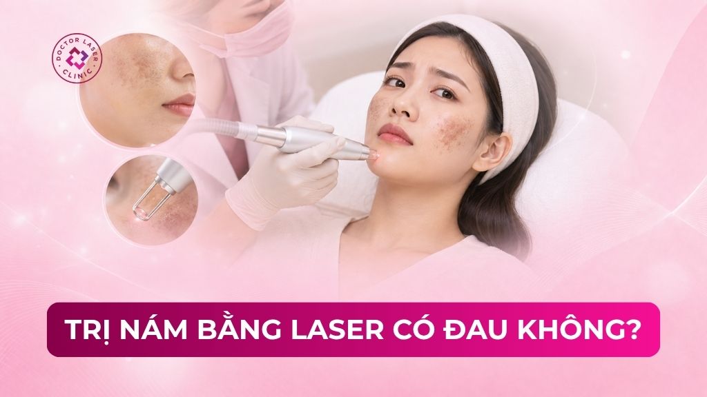 Điều trị nám bằng laser có đau không? Hướng dẫn cách làm dịu
