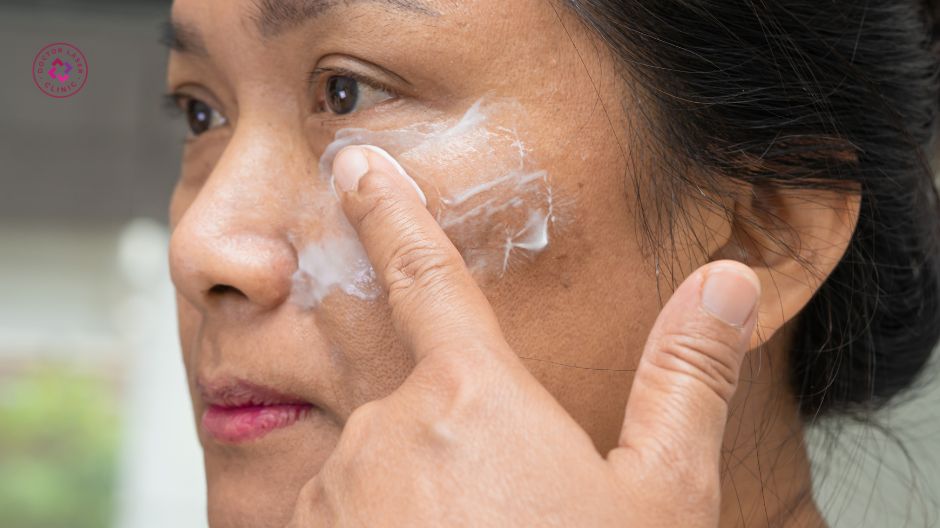 kem bôi theo chỉ định điều trị nám da sau sinh