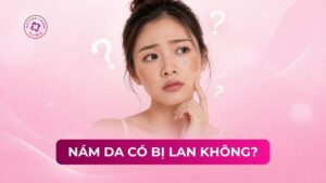 nám da có bị lan không