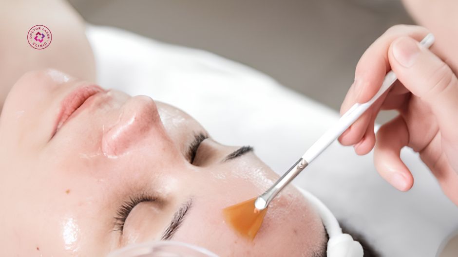 peel da điều trị nám