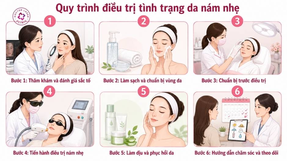 quy trình điều trị tình trạng da nám nhẹ