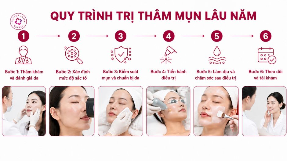 quy trình trị thâm mụn lâu năm