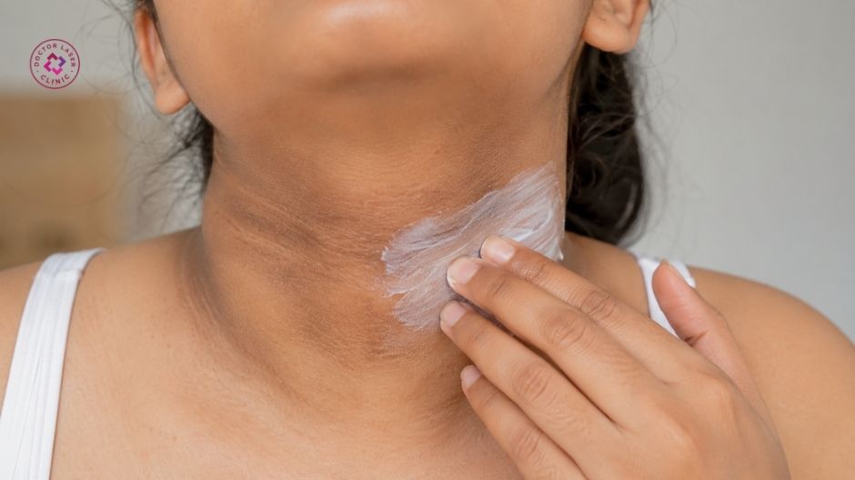 sử dụng thuốc bôi đặc trị điều trị cổ bị thâm đen