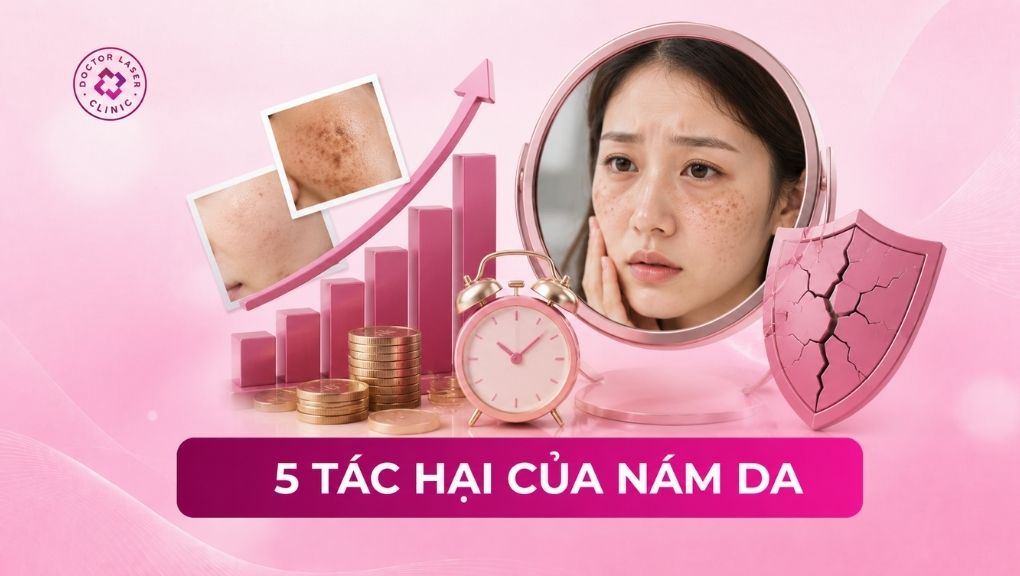 5 tác hại của nám da và một số lưu ý khi điều trị