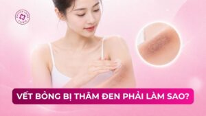 vết bỏng bị thâm đen phải làm sao vết bỏng bị thâm đen phải làm sao