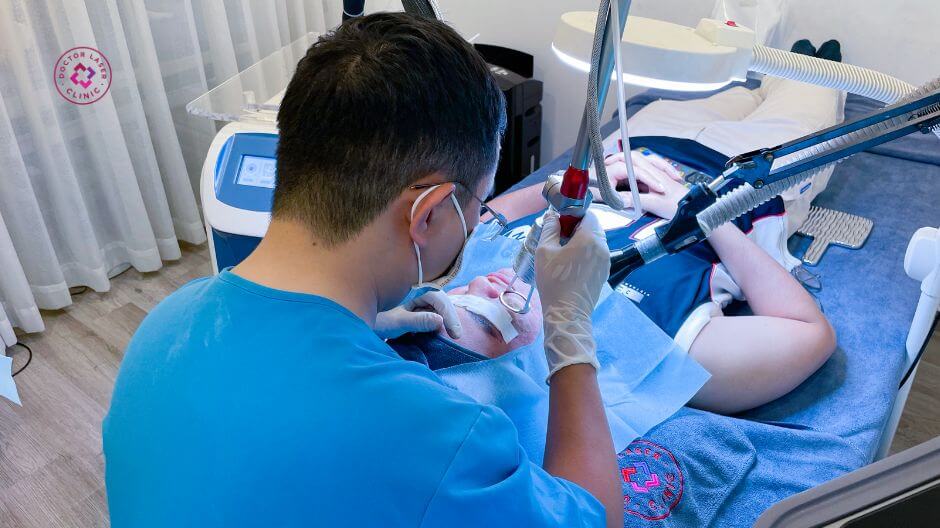 bắn laser
