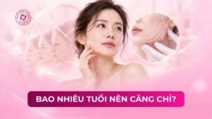 bao nhiêu tuổi nên căng chỉ bao nhiêu tuổi nên căng chỉ