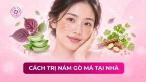 cách trị nám gò má tại nhà