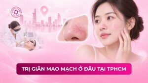 trị giãn mao mạch ở đâu tại tphcm