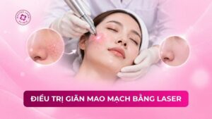 điều trị giãn mao mạch bằng laser