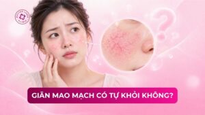 giãn mao mạch có tự khỏi không