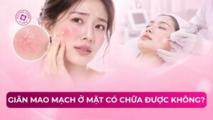 giãn mao mạch ở mặt có chữa được không