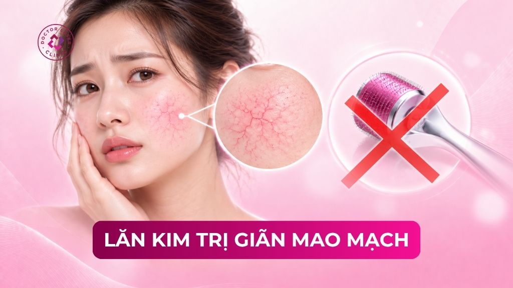 Lăn kim trị giãn mao mạch có hiệu quả không? Lưu ý cần biết