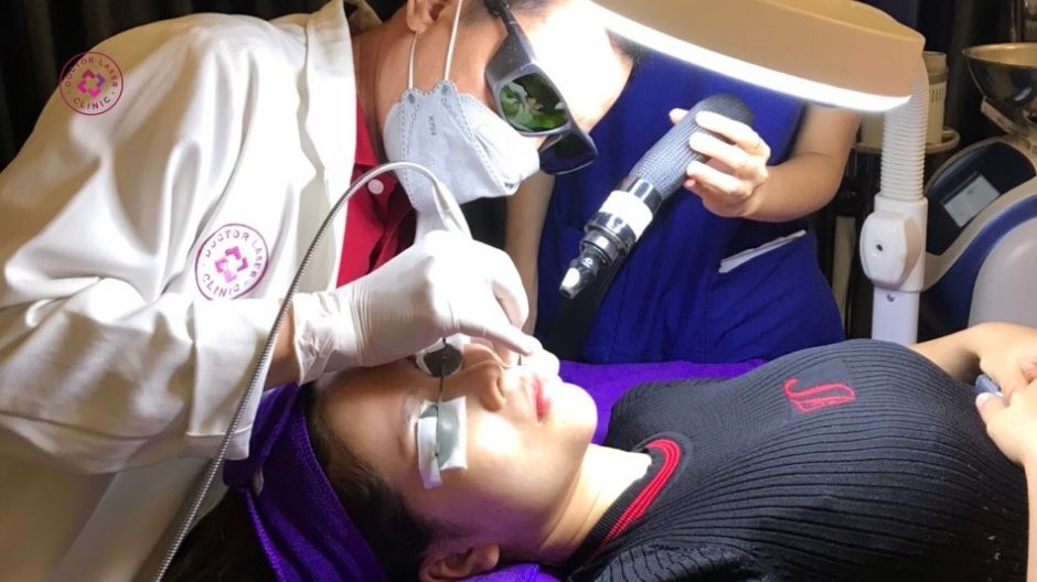 laser điều trị giãn mao mạch