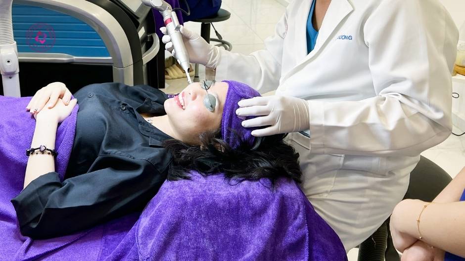 laser điều trị nám cánh bướm