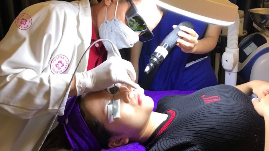 laser mạch máu điều trị giãn mao mạch