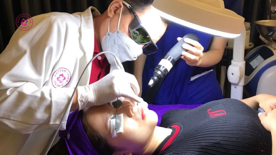 laser pico điều trị bớt hori