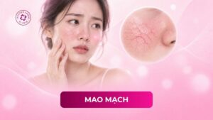 mao mạch