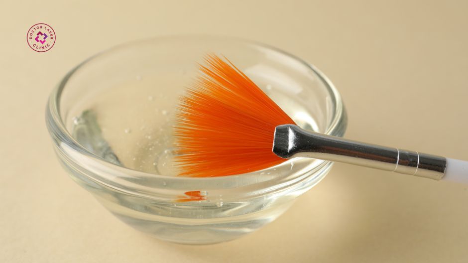 peel da điều trị nám do mỹ phẩm
