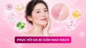 phục hồi da bị giãn mao mạch