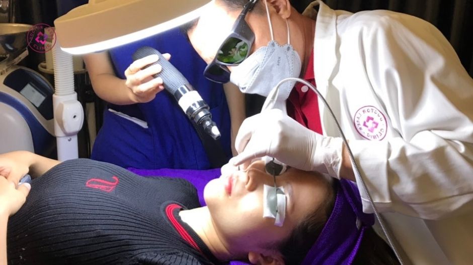 quy trình điều trị giãn mao mạch bằng laser