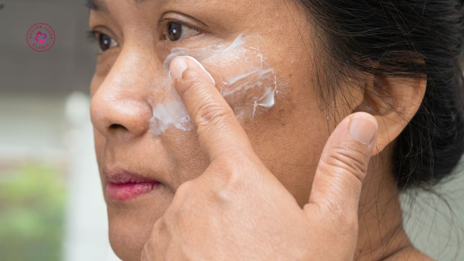 thuốc bôi và hoạt chất điều trị nám