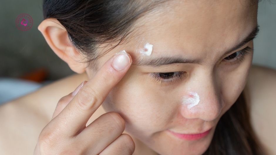 thuốc và hoạt chất bôi điều trị nám đốm