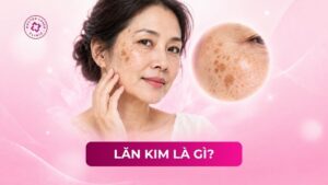 đồi mồi