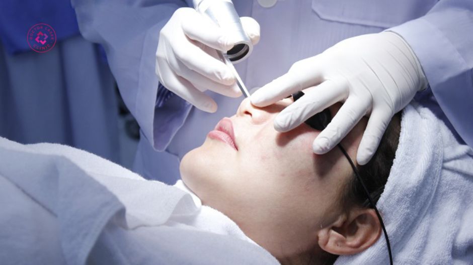 liệu pháp laser điều trị rối loạn sắc tố bẩm sinh