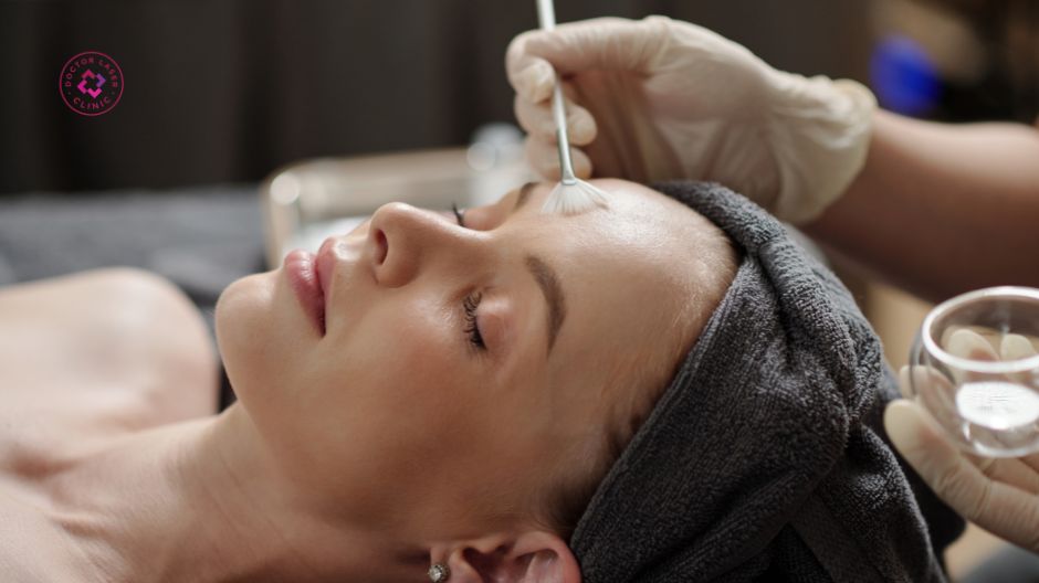 peel da điều trị nám nông