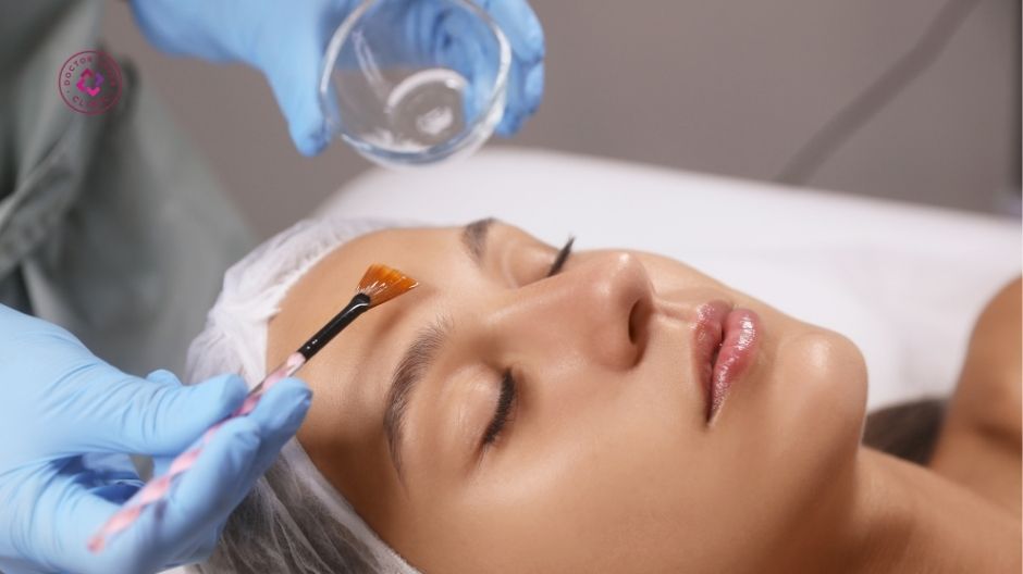 peel hóa học cải thiện thâm mụn