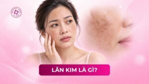 sạm da
