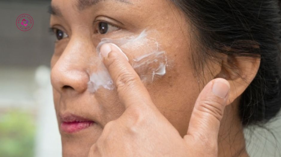 sử dụng kem chống nắng phòng ngừa nám